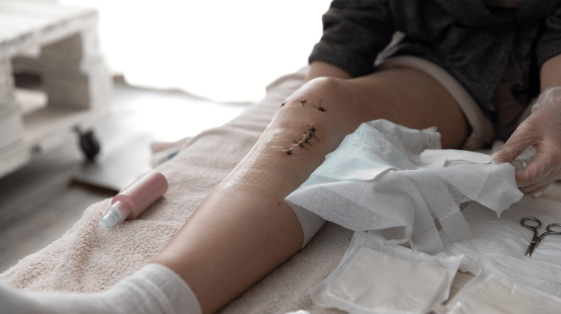 Post-Surgery-Royal-Rehab-Oakville